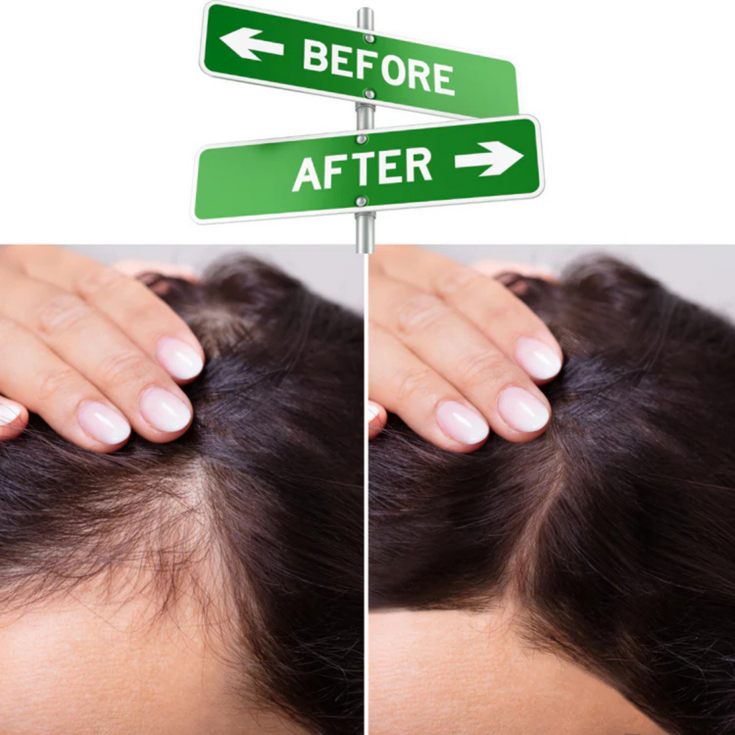 DUO GROW POUSSE | Traitement Complet Anti-Chute et Stimulation de la Pousse | TRENDYFLAIR